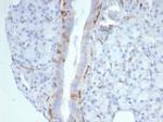 Cytokeratin 14 (KRT14) (Squamous Cell Marker) Antibody in Immunohistochemistry (Paraffin) (IHC (P))