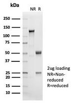 Cytokeratin 14 (KRT14) (Squamous Cell Marker) Antibody in SDS-PAGE (SDS-PAGE)