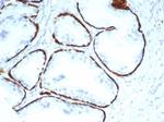 Cytokeratin 14 (KRT14) (Squamous Cell Marker) Antibody in Immunohistochemistry (Paraffin) (IHC (P))