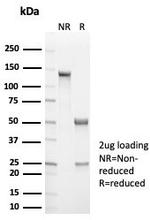 Cytokeratin 14 (KRT14) (Squamous Cell Marker) Antibody in SDS-PAGE (SDS-PAGE)