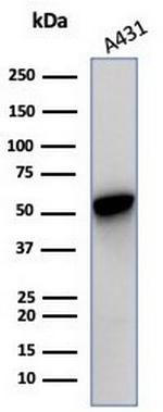 Cytokeratin 14 (KRT14) (Squamous Cell Marker) Antibody in Western Blot (WB)