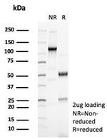 Cytokeratin 14 (KRT14) (Squamous Cell Marker) Antibody in SDS-PAGE (SDS-PAGE)