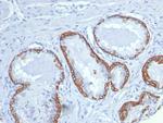 Cytokeratin 14 (KRT14) (Squamous Cell Marker) Antibody in Immunohistochemistry (Paraffin) (IHC (P))