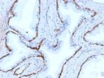 Cytokeratin 14 (KRT14) (Squamous Cell Marker) Antibody in Immunohistochemistry (Paraffin) (IHC (P))