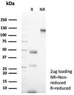 Cytokeratin 14 (KRT14) (Squamous Cell Marker) Antibody in SDS-PAGE (SDS-PAGE)