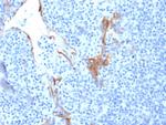 Cytokeratin 16 (KRT16) (Suprabasal Keratinocyte Marker) Antibody in Immunohistochemistry (Paraffin) (IHC (P))