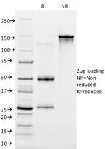 Cytokeratin 16 (KRT16) (Suprabasal Keratinocyte Marker) Antibody in SDS-PAGE (SDS-PAGE)