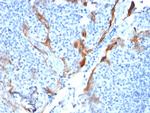 Cytokeratin 16 (KRT16) Antibody in Immunohistochemistry (Paraffin) (IHC (P))