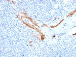 Cytokeratin 16 (KRT16) (Suprabasal Keratinocyte Marker) Antibody in Immunohistochemistry (Paraffin) (IHC (P))