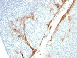 Cytokeratin 16 (KRT16) Antibody in Immunohistochemistry (Paraffin) (IHC (P))