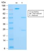 Cytokeratin 16 (KRT16) Antibody in SDS-PAGE (SDS-PAGE)