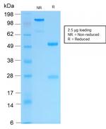 Cytokeratin 16 (KRT16) (Suprabasal Keratinocyte Marker) Antibody in SDS-PAGE (SDS-PAGE)