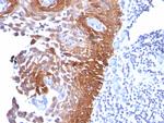 Cytokeratin 17 (KRT17) (Basal Epithelial Marker) Antibody in Immunohistochemistry (Paraffin) (IHC (P))