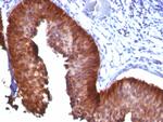 Cytokeratin 17 (KRT17) (Basal Epithelial Marker) Antibody in Immunohistochemistry (Paraffin) (IHC (P))