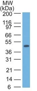 Cytokeratin 17 (KRT17) (Basal Epithelial Marker) Antibody in Western Blot (WB)