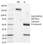 Cytokeratin 17 (CK17) (Basal Epithelial Marker) Antibody in SDS-PAGE (SDS-PAGE)