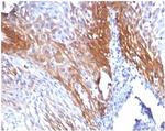 Cytokeratin 17 (CK17) (Basal Epithelial Marker) Antibody in Immunohistochemistry (Paraffin) (IHC (P))