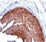 Cytokeratin 17 (CK17) (Basal Epithelial Marker) Antibody in Immunohistochemistry (Paraffin) (IHC (P))