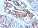 Cytokeratin 17 (CK17) (Basal Epithelial Marker) Antibody in Immunohistochemistry (Paraffin) (IHC (P))