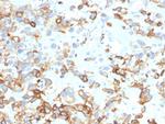 Cytokeratin 17 (CK17) (Basal Epithelial Marker) Antibody in Immunohistochemistry (Paraffin) (IHC (P))