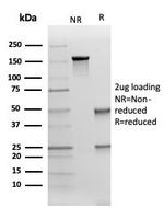 Cytokeratin 17 (CK17) (Basal Epithelial Marker) Antibody in SDS-PAGE (SDS-PAGE)