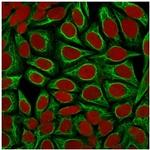 Cytokeratin 18 (KRT18) Antibody in Immunocytochemistry (ICC/IF)