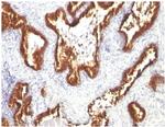 Cytokeratin 18 (KRT18) Antibody in Immunohistochemistry (Paraffin) (IHC (P))