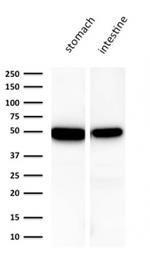 Cytokeratin 18 (KRT18) Antibody in Western Blot (WB)