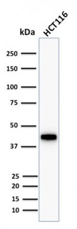 Cytokeratin 18 (KRT18) Antibody in Western Blot (WB)