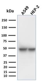 Cytokeratin 18 (KRT18) Antibody in Western Blot (WB)