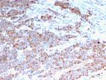 Cytokeratin 18 (KRT18) Antibody in Immunohistochemistry (Paraffin) (IHC (P))