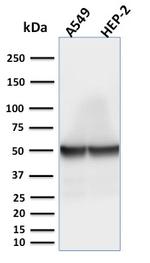 Cytokeratin 18 (KRT18) Antibody in Western Blot (WB)