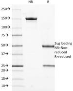 Cytokeratin 18 (KRT18) Antibody in SDS-PAGE (SDS-PAGE)