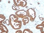 Cytokeratin 18 (KRT18) Antibody in Immunohistochemistry (Paraffin) (IHC (P))