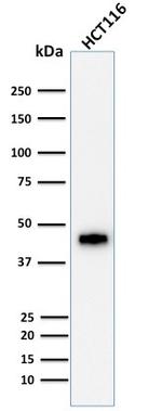 Cytokeratin 18 (KRT18) Antibody in Western Blot (WB)