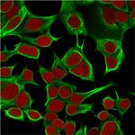 Cytokeratin 18 (KRT18) Antibody in Immunocytochemistry (ICC/IF)