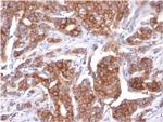 Cytokeratin 18 (KRT18) Antibody in Immunohistochemistry (Paraffin) (IHC (P))