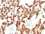 Cytokeratin 18 (KRT18) Antibody in Immunohistochemistry (Paraffin) (IHC (P))