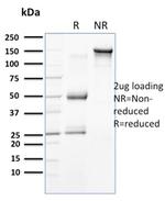 Cytokeratin 18 (KRT18) Antibody in SDS-PAGE (SDS-PAGE)