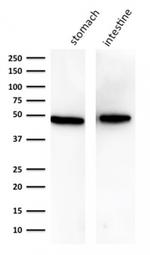 Cytokeratin 18 (KRT18) Antibody in Western Blot (WB)