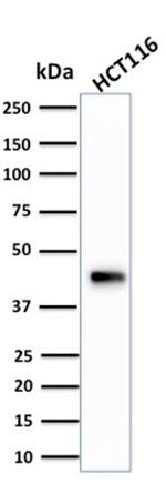 Cytokeratin 18 (KRT18) Antibody in Western Blot (WB)