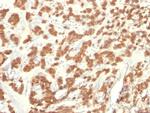 Cytokeratin 18 (KRT18) Antibody in Immunohistochemistry (Paraffin) (IHC (P))