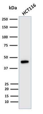 Cytokeratin 18 (KRT18) Antibody in Western Blot (WB)