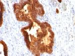 Cytokeratin 18 (KRT18) Antibody in Immunohistochemistry (Paraffin) (IHC (P))