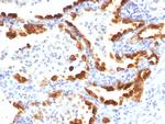 Cytokeratin 18 (KRT18) Antibody in Immunohistochemistry (Paraffin) (IHC (P))