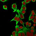 Cytokeratin 18 (KRT18) Antibody in Immunocytochemistry (ICC/IF)