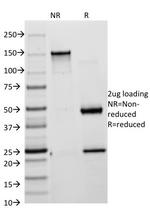 Cytokeratin 18 (KRT18) Antibody in SDS-PAGE (SDS-PAGE)