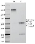 Cytokeratin 18 (KRT18) Antibody in SDS-PAGE (SDS-PAGE)