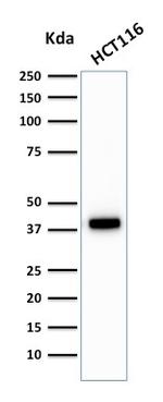 Cytokeratin 18 (KRT18) Antibody in Western Blot (WB)