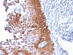 Cytokeratin 18 (KRT18) Antibody in Immunohistochemistry (Paraffin) (IHC (P))